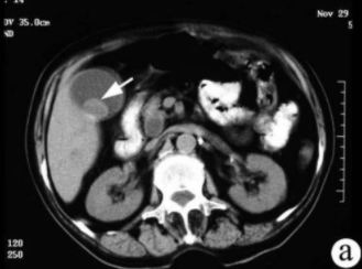 đ�ҽYʯ��CTӰ����F