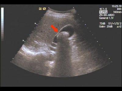 đ�Y(ji��)ʯ�DƬ