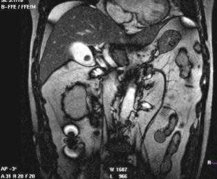 đ�ҽYʯ��CTӰ����F