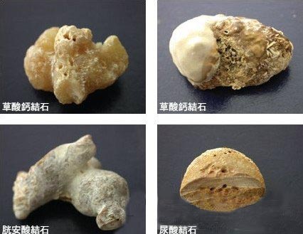 ��ͬ�ɷ��I�Yʯ�ĸ��N���c