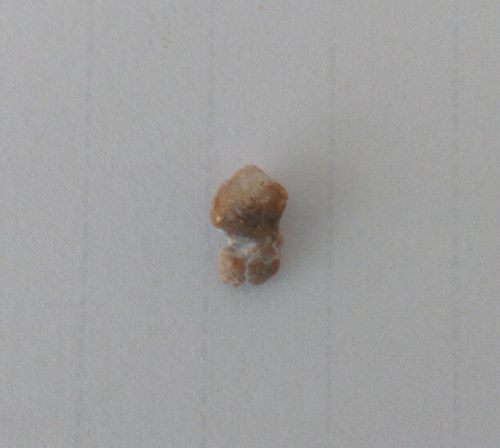 ��Ҏ�t�ΑB��ݔ��ܽYʯ