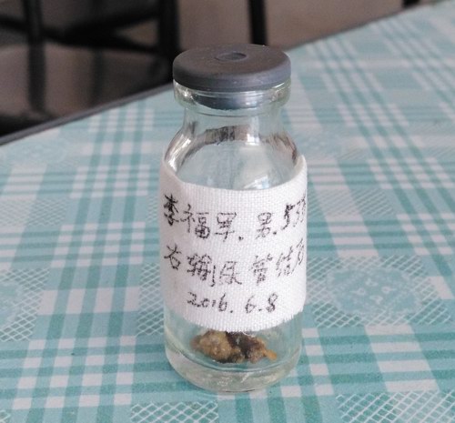 ��^ָᘯ����ί�ݔ���ĩ�˽Y(ji��)ʯ