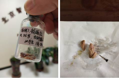 ��^ָᘯ����ί����ݔ��ܽY(ji��)ʯ