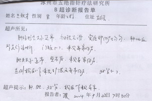 右肝內膽管結石合并左輸石