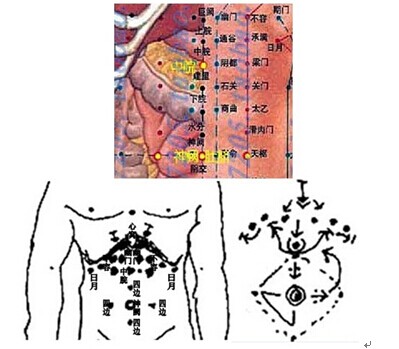五絕指針療法通膈開胃法的應用