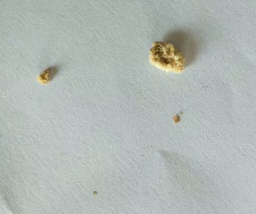 定興五絕指針療法養生館遷新址