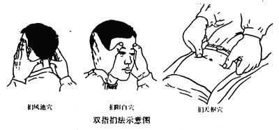 指針療法常用的四種操作方法